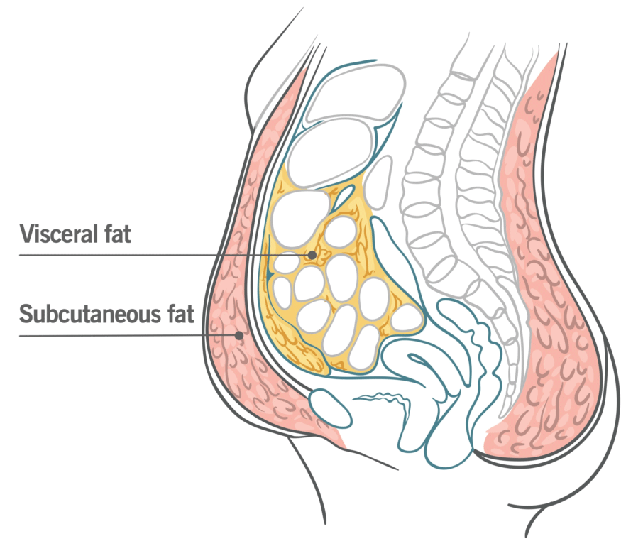 Study Reveals Link Between Sleep Deprivation and Unhealthy Belly Fat Accumulation