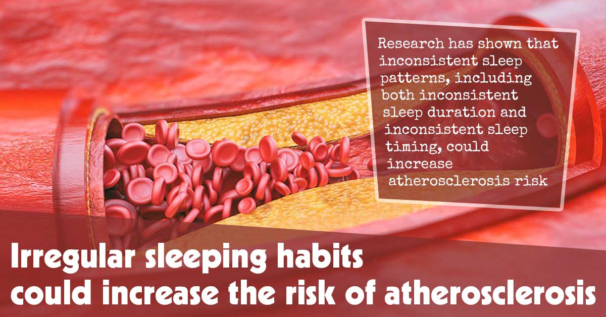 The Link Between Irregular Sleep Patterns and Atherosclerosis Risk